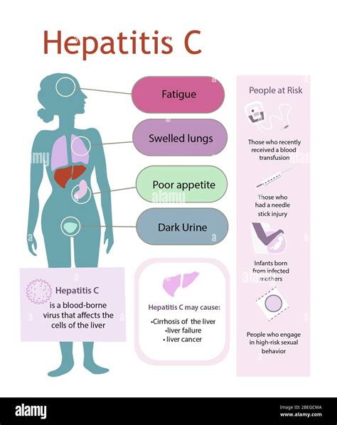 Hepatitis C and the Hep C Virus .